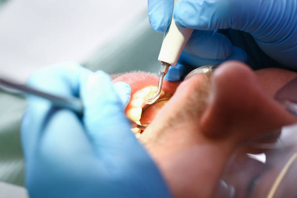 Best Urgent Care for Lost Fillings or Crowns in Sandy Springs, GA